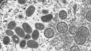 Vírus da varíola dos macacos vistos através do microscópio