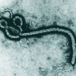 São Paulo investiga caso suspeito de Ebola em homem de 37 anos
