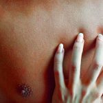 Não confunda compulsividade sexual com liberdade sexual