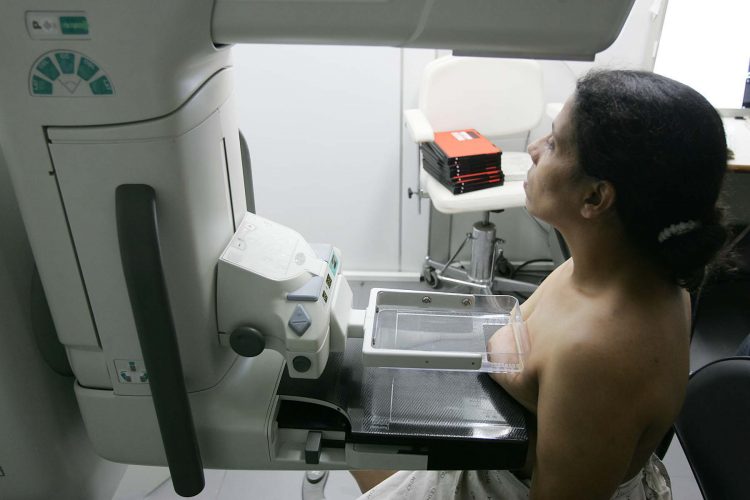 Mulher faz exame de mamografia