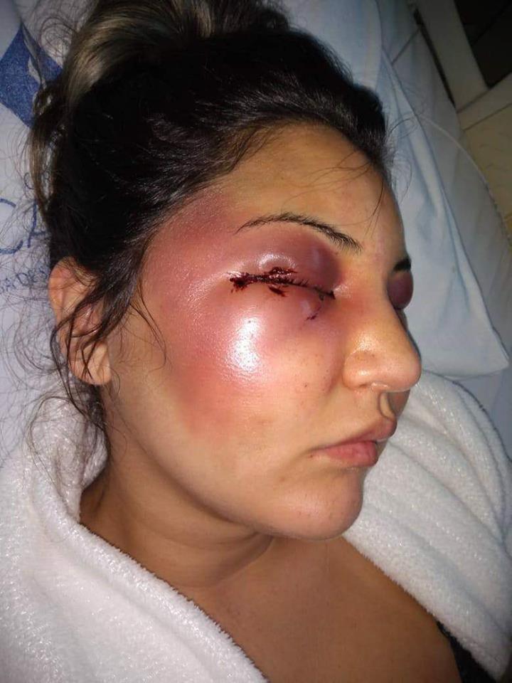 Christini Cardoso de França foi agredida pelo marido, Fábio Tuffy Felippe, em 21 de dezembro, no Rio de Janeiro