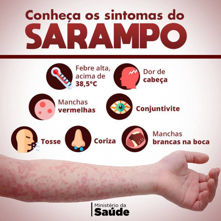 Entenda como o sarampo pode levar à morte | Jovem Pan