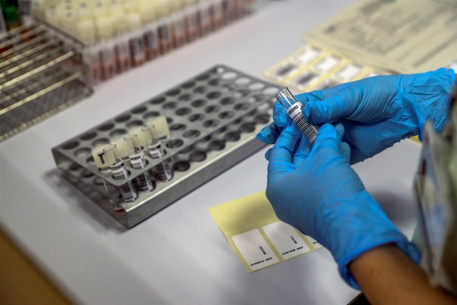 Estados Unidos confirmam primeiro caso de varíola do macaco em 2022