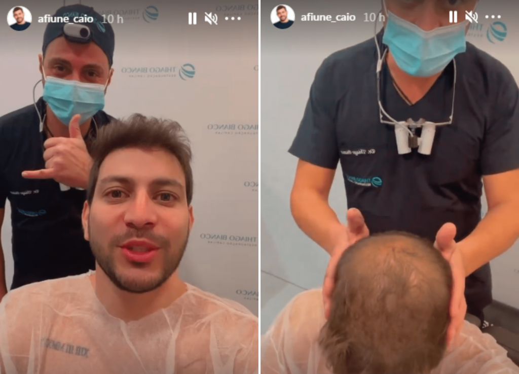 Médico mostra calvície de Caio
