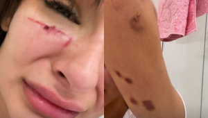 montagem de fotos de mulher agredida