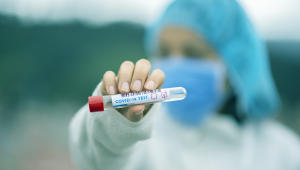 Enfermeira segurando teste de sangue para detectar a Covid-19