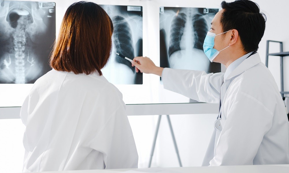 Ao lado de uma colega de jaleco, médico de origem asiática aponta um radiografia de pulmão (a do meio entre três radiografias penduradas)