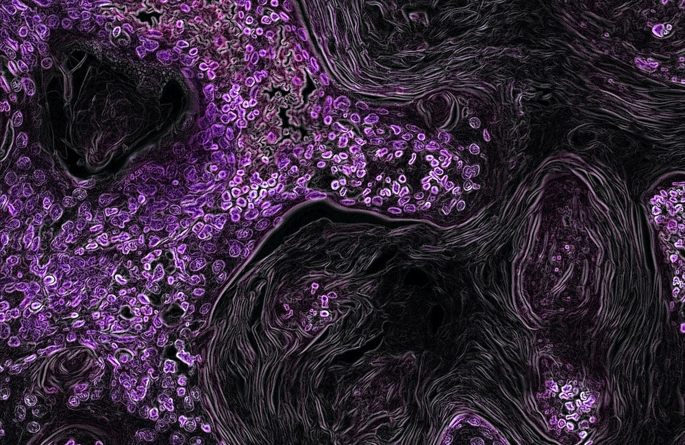 Imagem de uma estrutura de células de câncer com micropontos roxos e outra parte preta que se assemelha com alguns fios de cabo