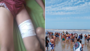 Criança de 11 anos é ferida por tubarão