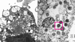 Primeira imagem por microscópio da variante Ômicron