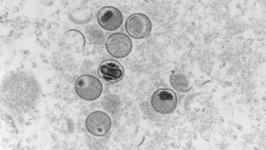 Captura microscopia eletrônica de seção ultrafina do víruos da varíola dos macacos