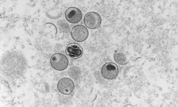Captura microscopia eletrônica de seção ultrafina do víruos da varíola dos macacos