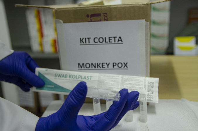 Vista de caixa com kits de testagem para detecção do vírus da varíola dos macacos