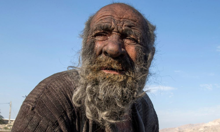 homem mais sujo do mundo morre após tomar banho