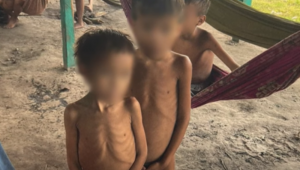 Crianças yanomami em situação de desnutrição