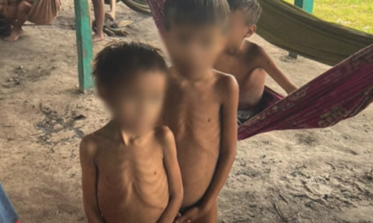 Crianças yanomami em situação de desnutrição
