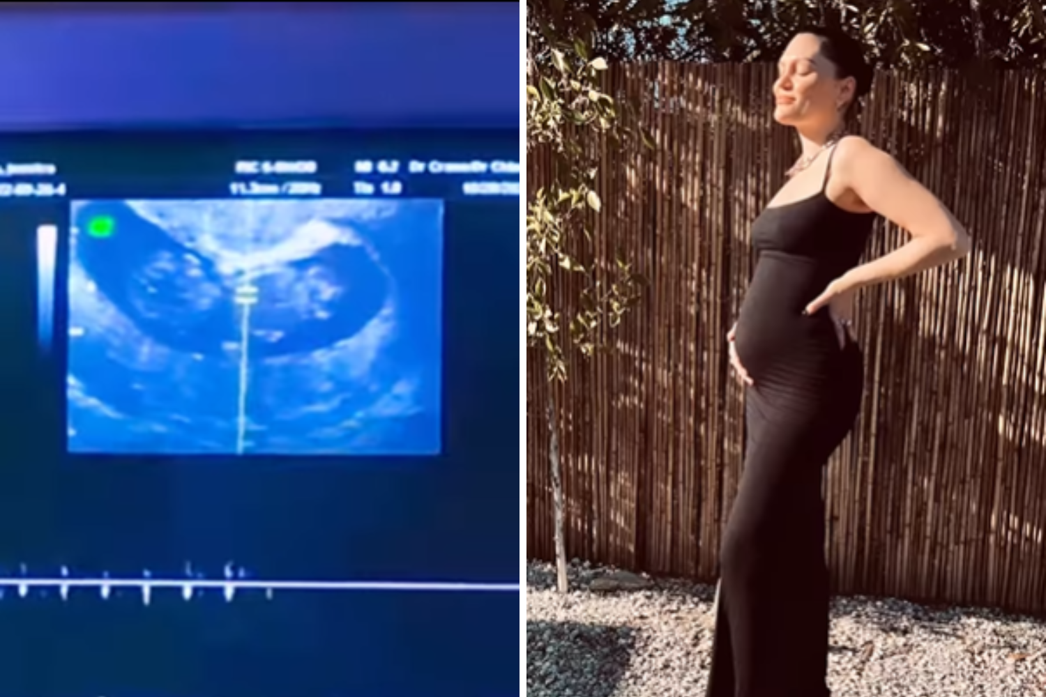Maite Perrone anuncia gravidez, Somos três