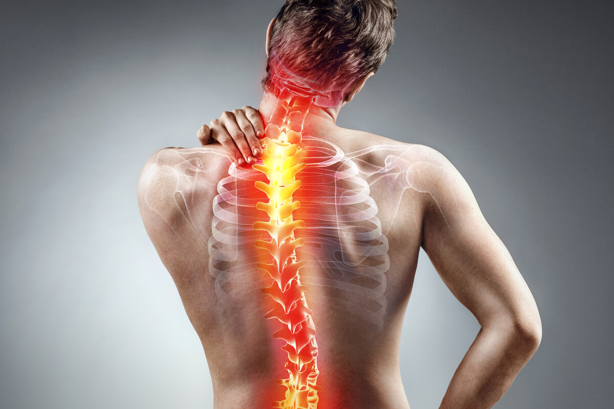 Escoliose é uma doença na coluna vertebral 