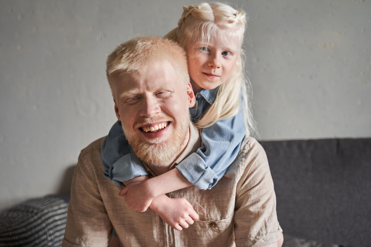 O albinismo é uma doença genética 