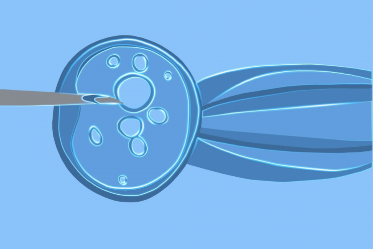 Ovodoação: veja quando é indicada essa técnica de reprodução assistida