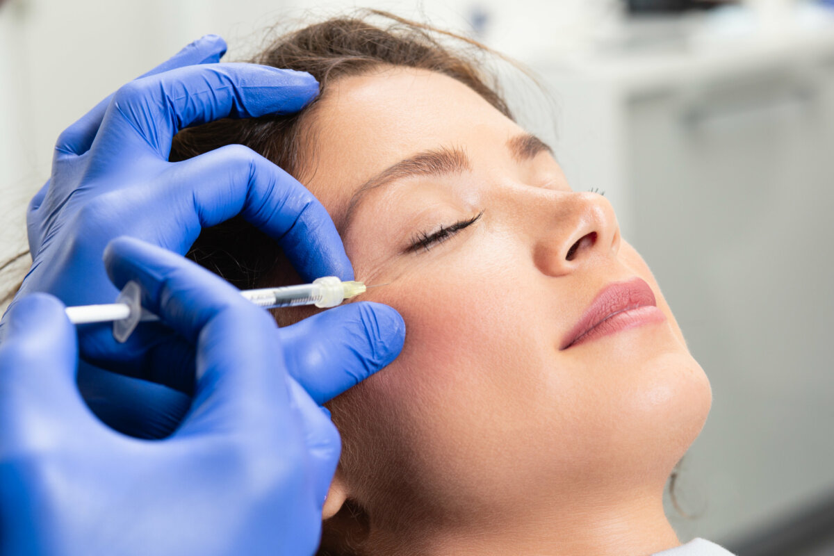 O procedimento envolve a injeção cuidadosa de ácido hialurônico na área das olheiras 