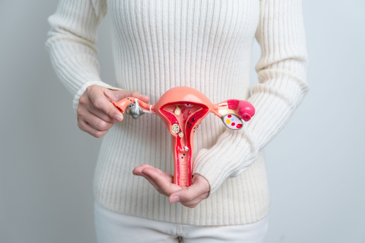 Ao receber o diagnóstico ultrassonográfico de miomas uterinos, o tratamento deve ser iniciado o mais breve possível 