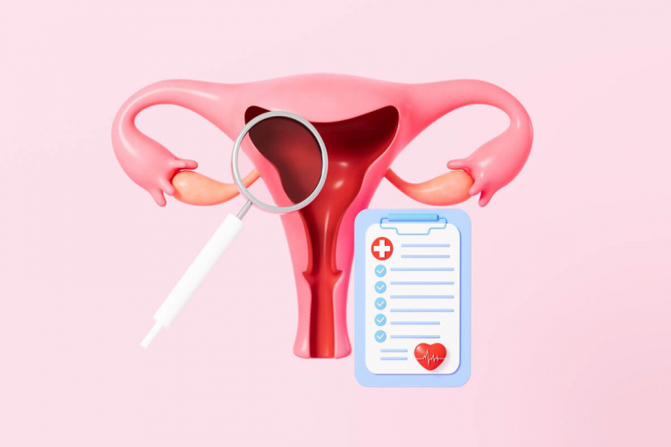5 mitos e verdades sobre endometriose