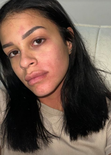 Namorada de Kauê Rodrigues postou nas redes sociais que foi agredida 