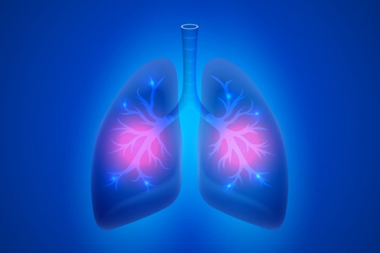 Conheça os sintomas da pneumonia e saiba como tratar