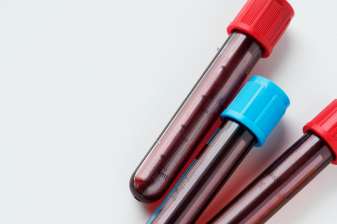 Tubos com coletas de sangue