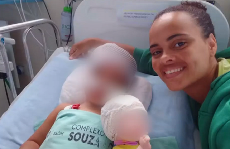 Menina baleada na cabeça no Rio retoma a consciência