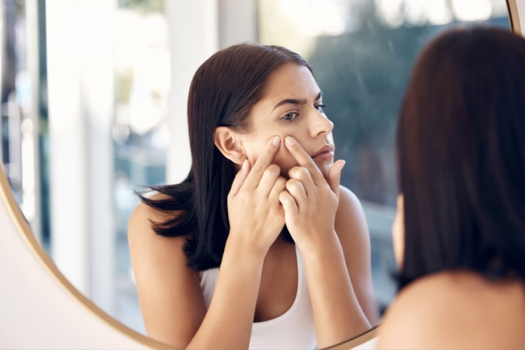 7 dicas para controlar a acne na vida adulta
