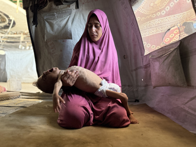 FOTODELDIA JERUSALÉN, 26/07/2025.- O pequeno gazatí Mohamed Motawaq, de tan solo 18 meses, de corpo esquelético pasa os dias em Gaza em brazos de sua mãe, Hidaya al Mutauaq, uma mulher viúva, de 30 anos, sem apenas leite e outros produtos básicos pelas restrições que Israel. A desnutrição mató para outras cinco pessoas, incluindo um bebê, nas últimas 24 horas em Gaza, informou o hospital Al Shifa da franja Palestina. EFE/Ahmad Awad