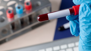 Cirurgião fazendo exame de sangue