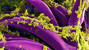 Yersinia pestis é um cocobacilo em forma de bastonete, imóvel e sem esporos, responsável pela peste