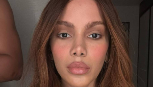 Anitta fala pela primeira vez sobre novos procedimentos estéticos: ‘O corpo é meu’