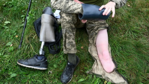 amputados russia e ucrania