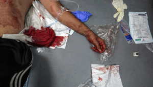 Graphic content / TOPSHOT - The body of a man, who died in the aftermath of bombardment on a displaced persons camp, lies at a trauma ward at the Aqsa Martyrs Hospital in Deir el-Balah in the central Gaza Strip on May 11, 2024 amid the ongoing conflict in the Palestinian territory between Israel and Hamas. (Photo by AFP)
