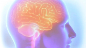 AVC, popularmente conhecido como derrame, figura atualmente como uma das principais causas de morte e incapacidade física no mundo