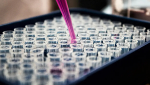 Estudos recentes feitos por cientistas brasileiros confirmaram o potencial de um exame de sangue para o diagnóstico do Alzheimer