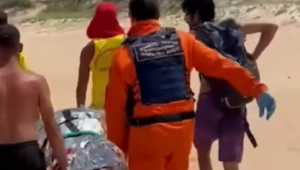 Mulher sofre ataque de capivara durante mergulho e fica sem parte da nádega