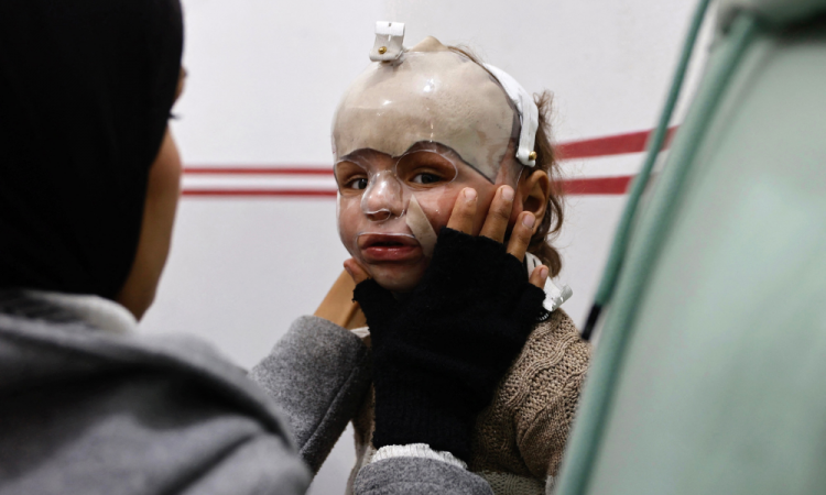 Uma criança usando uma máscara protetora de acrílico chega à clínica Médicos Sem Fronteiras (MSF) no bairro de al-Rimal, na Cidade de Gaza, na véspera de Ano Novo, 31 de dezembro de 2025. Israel afirmou que 37 organizações de ajuda humanitária serão proibidas de operar em Gaza a partir de 1º de janeiro de 2026, a menos que cumpram as diretrizes que exigem informações detalhadas sobre a equipe palestina, atraindo críticas das Nações Unidas e da União Europeia.