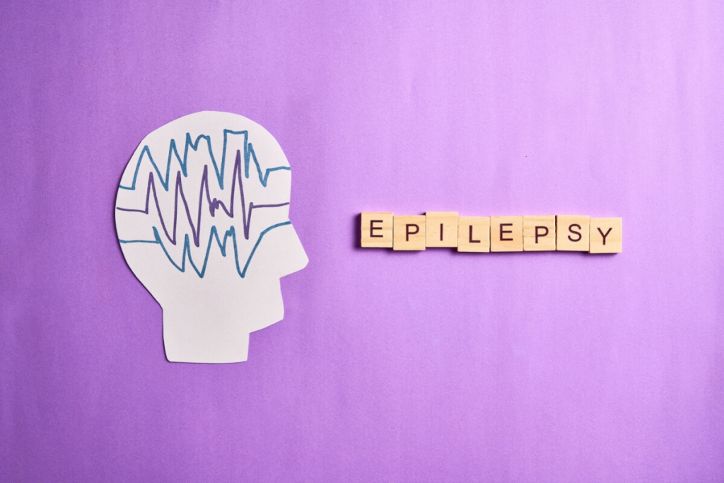 Dia Internacional da Epilepsia: veja como prevenir e agir durante as crises