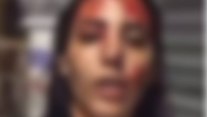 Mulher presa após esfaquear namorado alega violência doméstica; veja vídeo