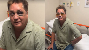 Cantor Leonardo sofre acidente e aparece com olho roxo