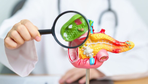 Pedra na vesícula: conheça os sintomas da doença