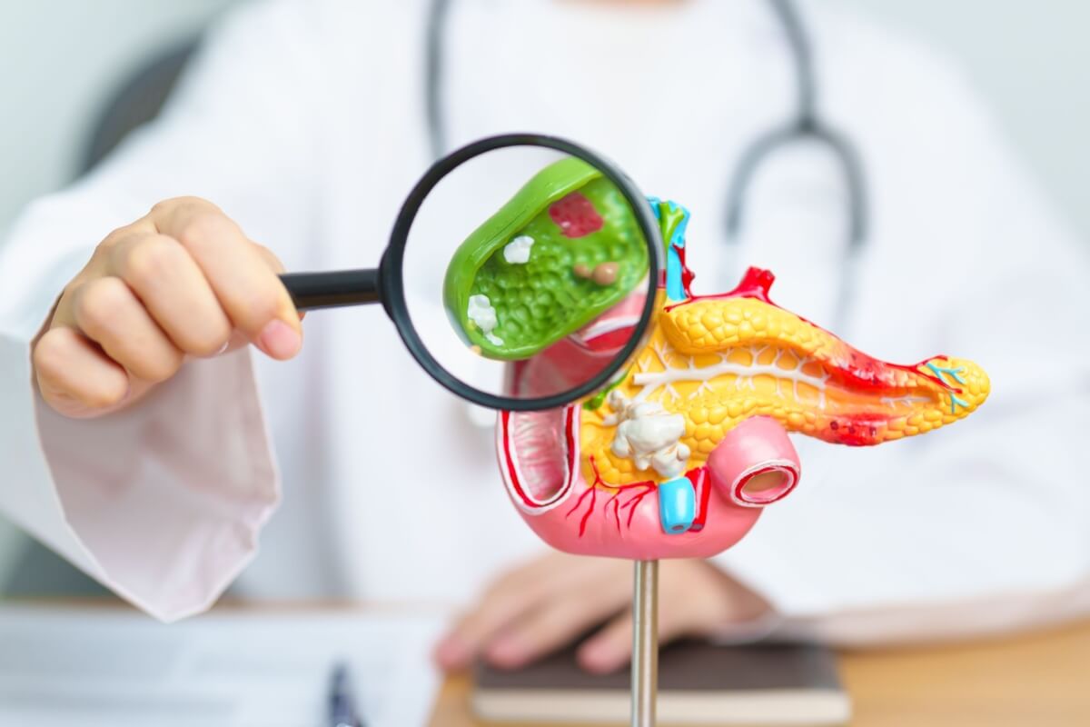 Sem tratamento adequado, a pedra na vesícula pode provocar novos episódios e levar a complicações mais graves 